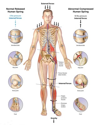 Overload of Stress Can Manifest Compression